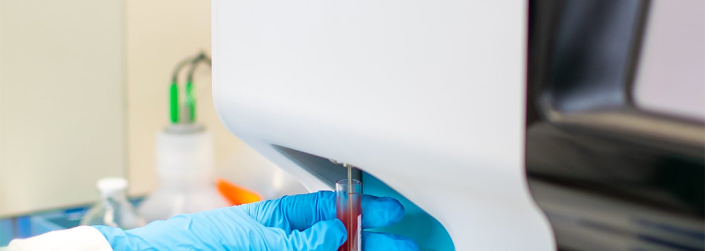 LAb